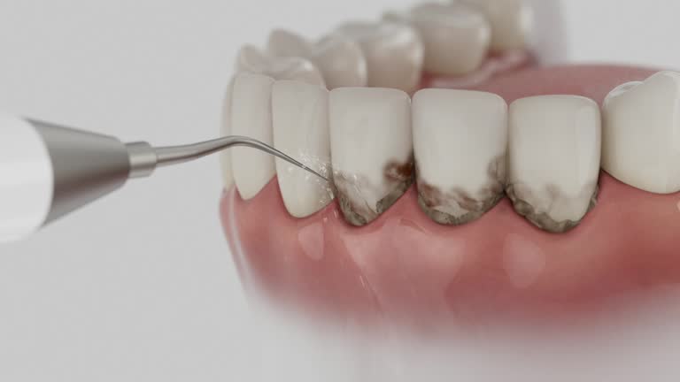 Trusted Dental Implants service in Wellston, OH - Dentist Open Now